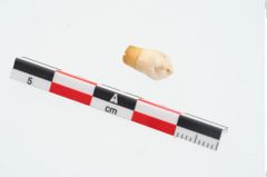 Foto von Menschenzahn (NHMW-PRAE-026154a)